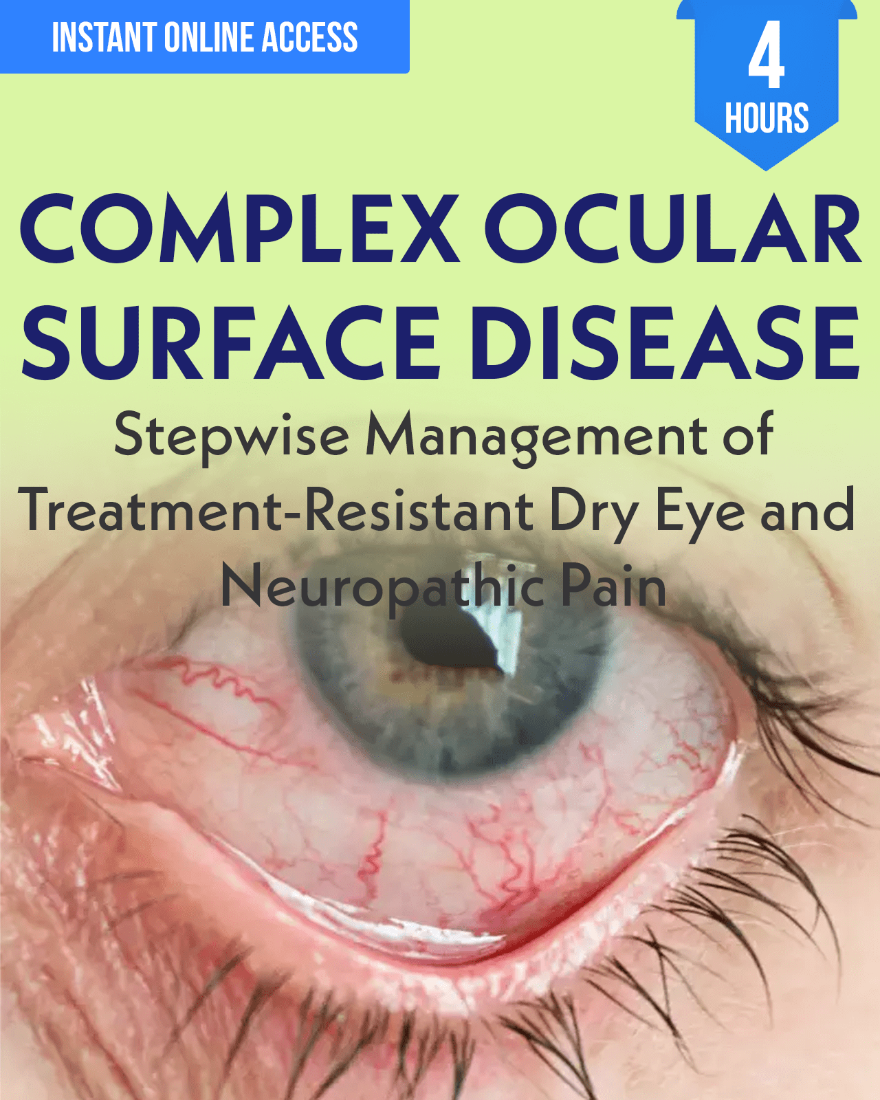 Complex Ocular Surface Disease: Stepwise Management of Treatment-Resistant Dry Eye and Neuropathic Pain - Optometry Continuing Education, 4 Hours Access Optometry