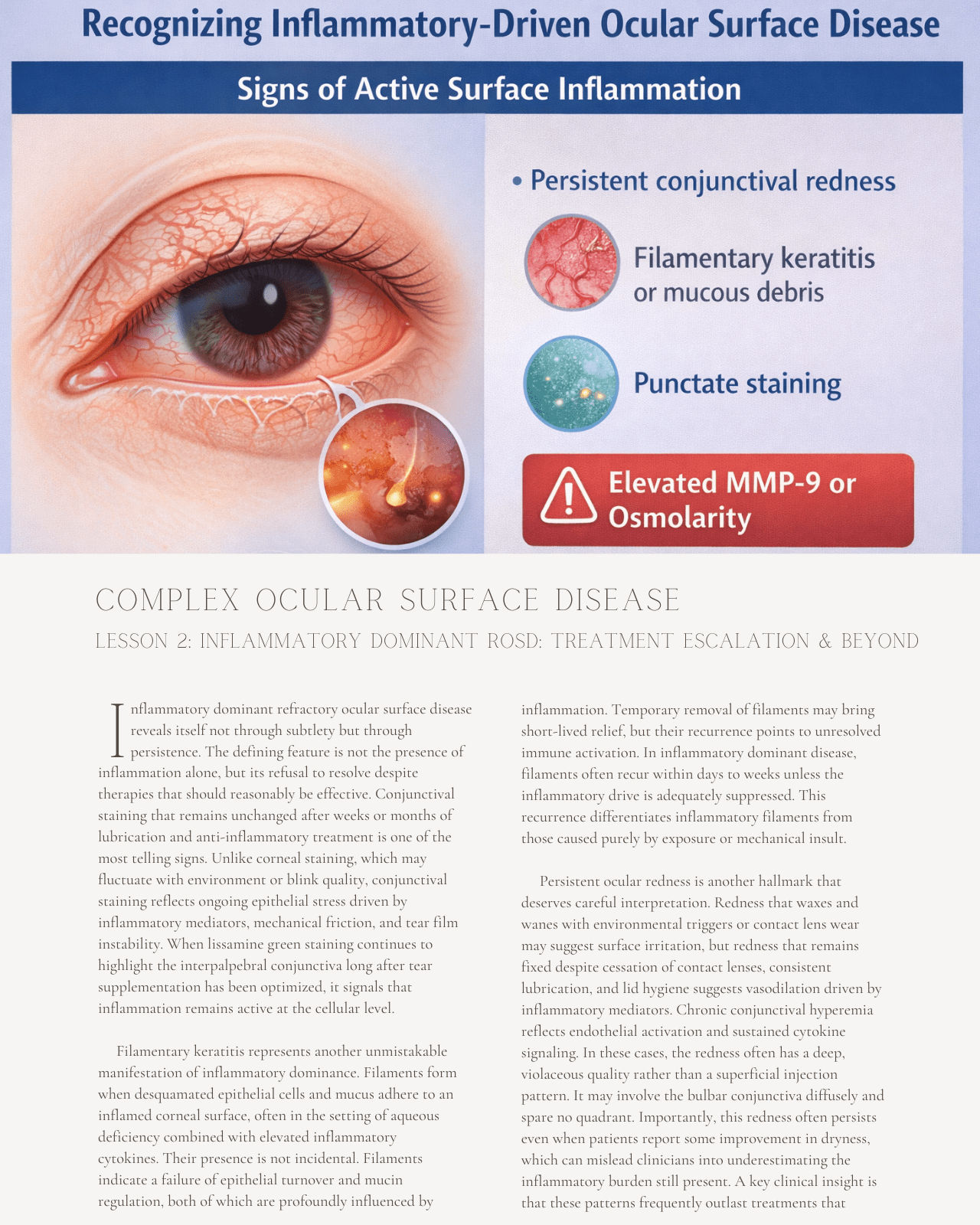 Complex Ocular Surface Disease: Stepwise Management of Treatment-Resistant Dry Eye and Neuropathic Pain - Optometry Continuing Education, 4 Hours Access Optometry
