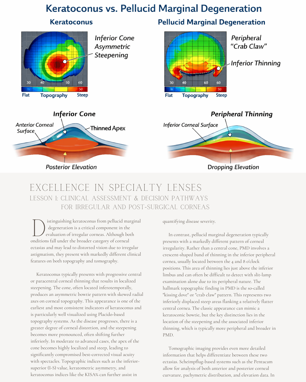 Excellence in Specialty Lenses: Advanced Contact Lens Strategies for Irregular and Post-Surgical Corneas - Optometry Continuing Education, 3 Hours Access Optometry