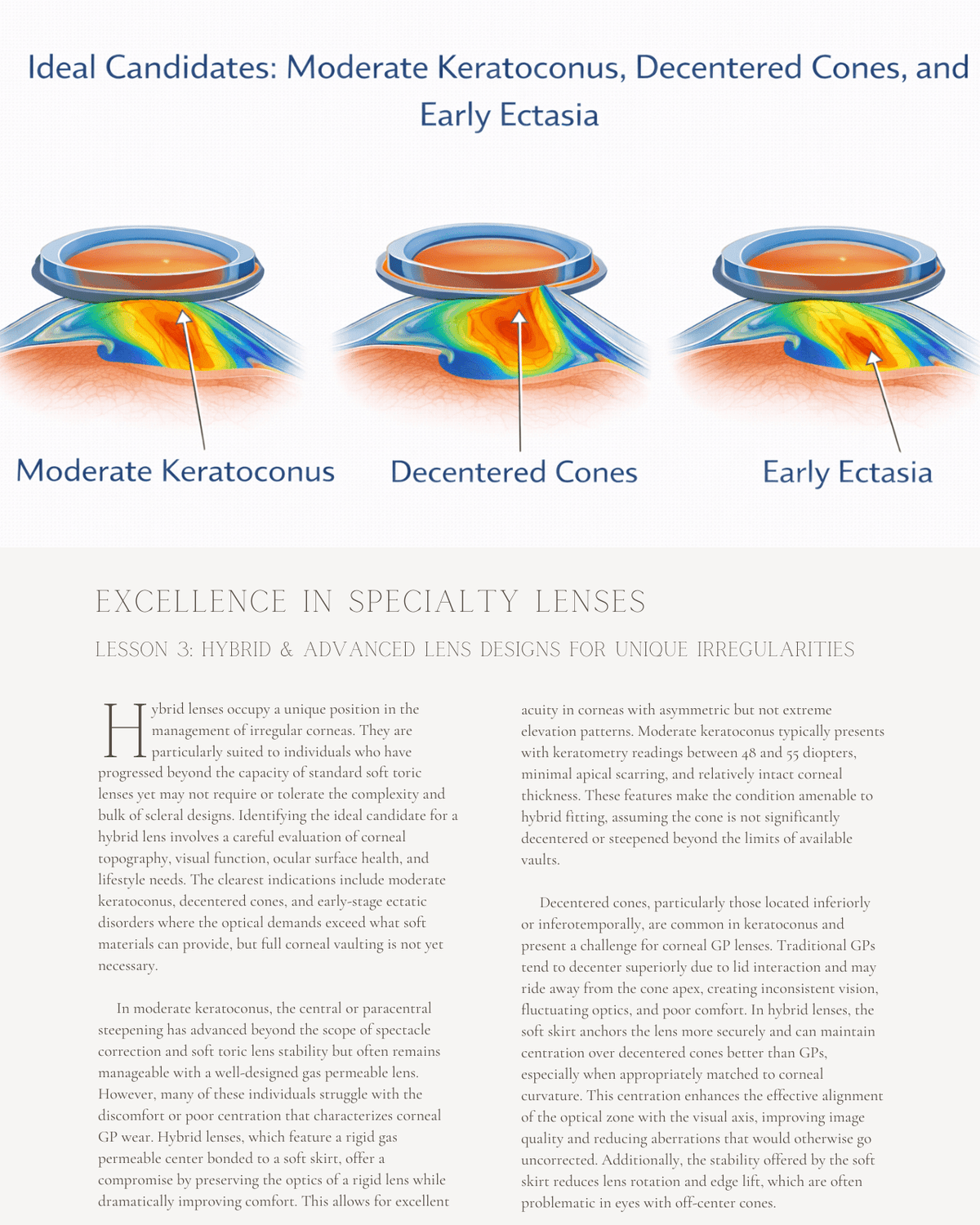 Instant Lens Optometry Excellence in Specialty Lenses: Advanced Contact Lens Strategies for I ...