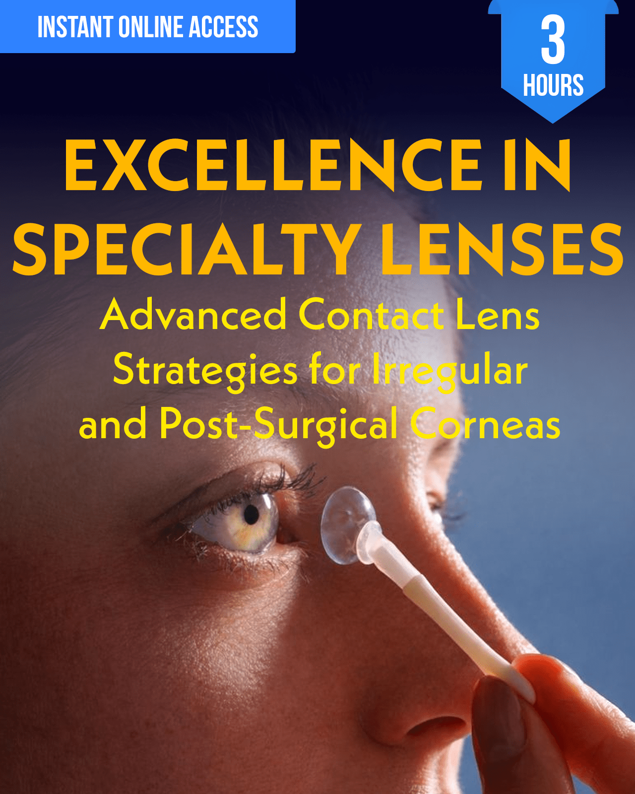 Excellence in Specialty Lenses: Advanced Contact Lens Strategies for Irregular and Post-Surgical Corneas - Optometry Continuing Education, 3 Hours Access Optometry